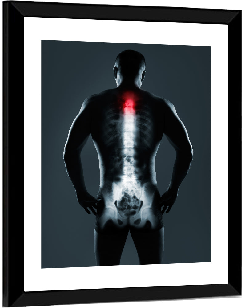 Human Spine X-Ray Wall Art