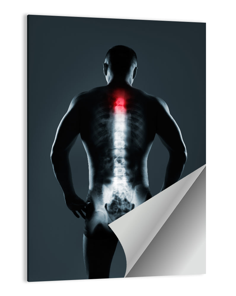 Human Spine X-ray Wall Art
